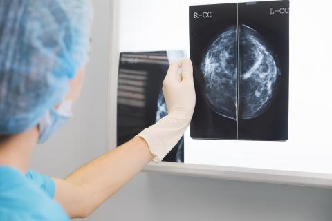 iStock-839295568CANCER_MAMA_20250603101619.jpg